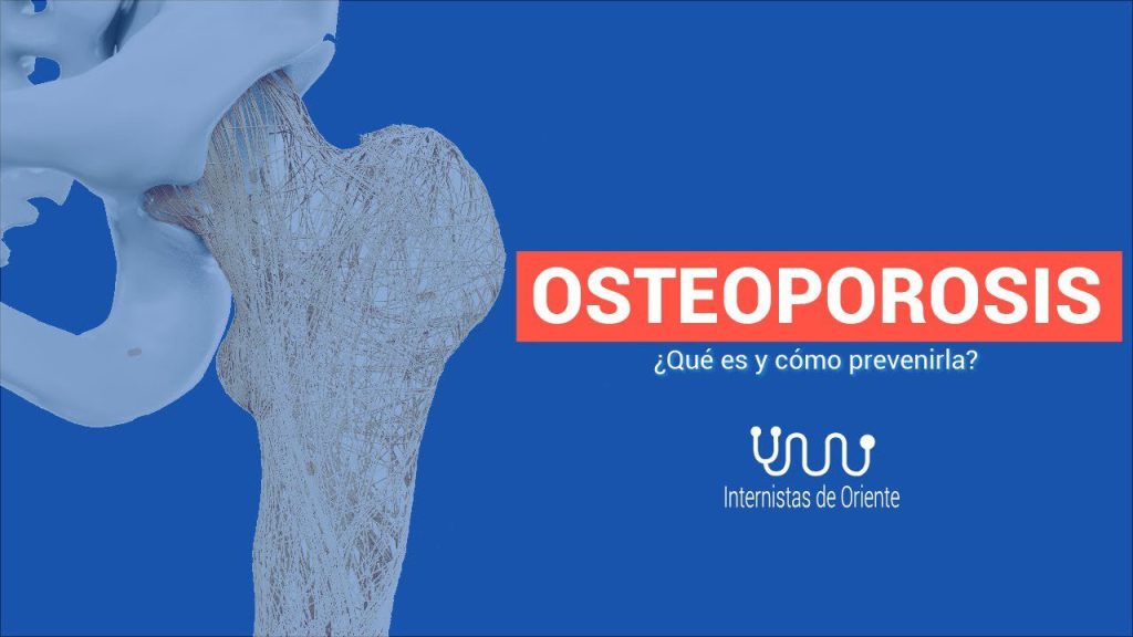 Osteoporosis como prevenirla