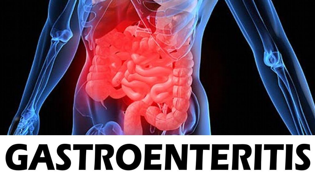 Gastroenteritis: Los síntomas